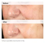 The Ordinary Alpha Arbutin 2% + HA 30ml – Image 3